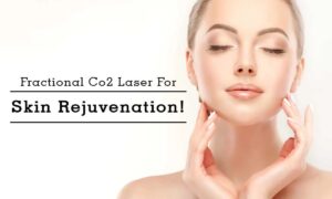 a person posing for the camera